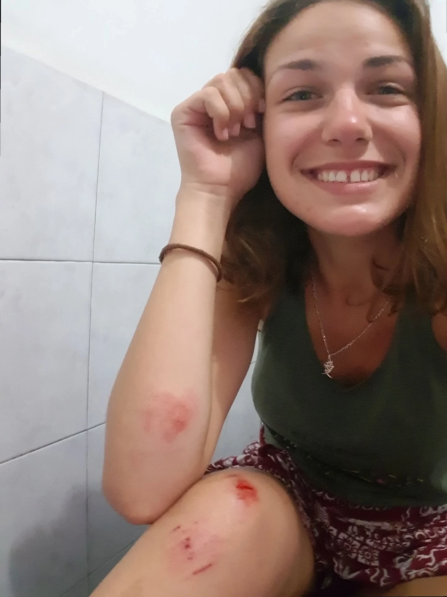 Accident Bali